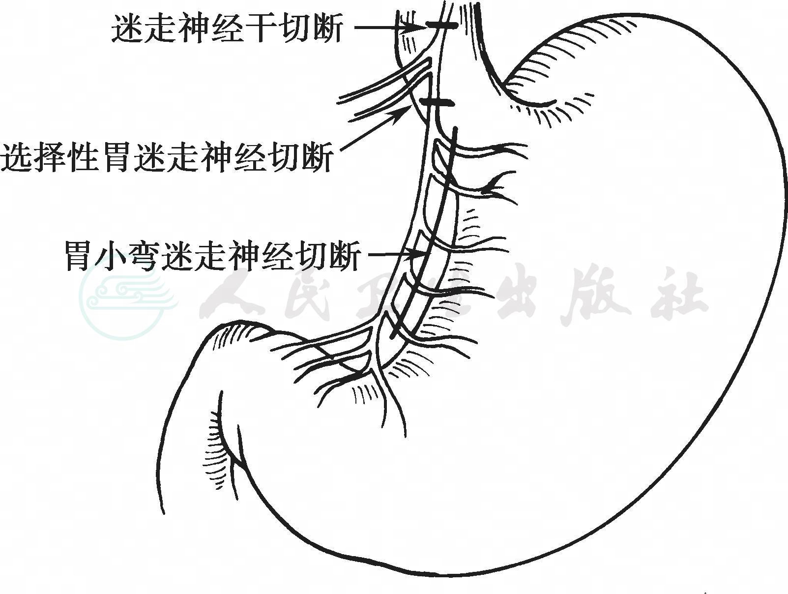 图2-181 胸后壁的血管神经(侧面观)-外科学-医学