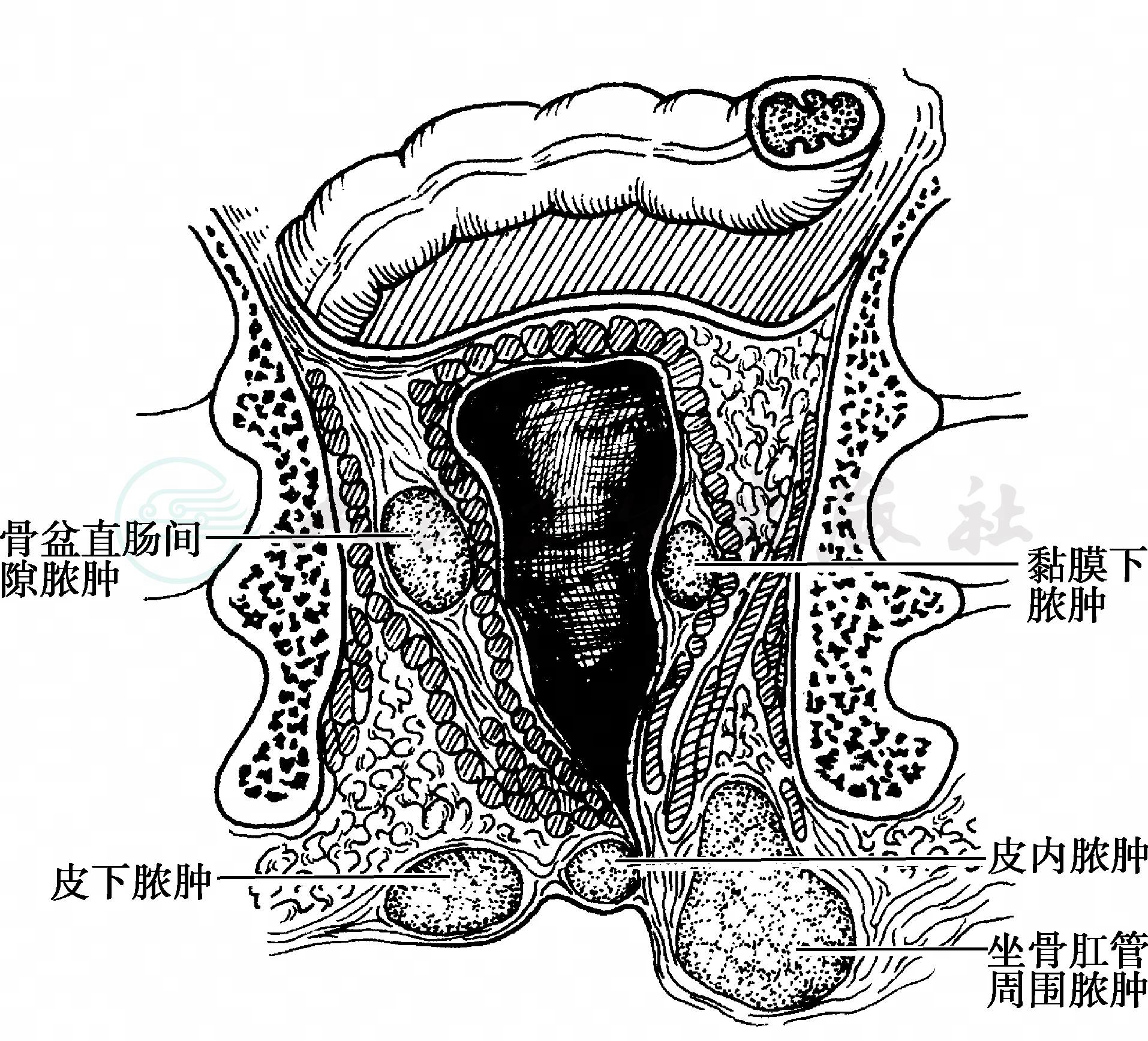 疾病详情-疾病-人卫临床助手-人民卫生出版社