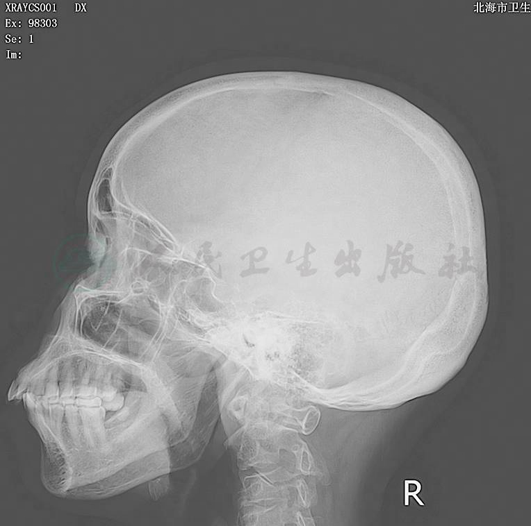 检查详情-人卫临床助手-人民卫生出版社