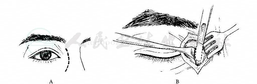 默认分类